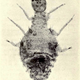 Illustration for article titled 110 Years Ago, These Microscopic Photos Horrified Londoners